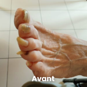 Pédicure médicale à Wanze Huy Andenne - Soin des pieds en Août